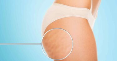 6 Exercices Faciles Pour Perdre Sa Cellulite En Seulement 2 Semaines.